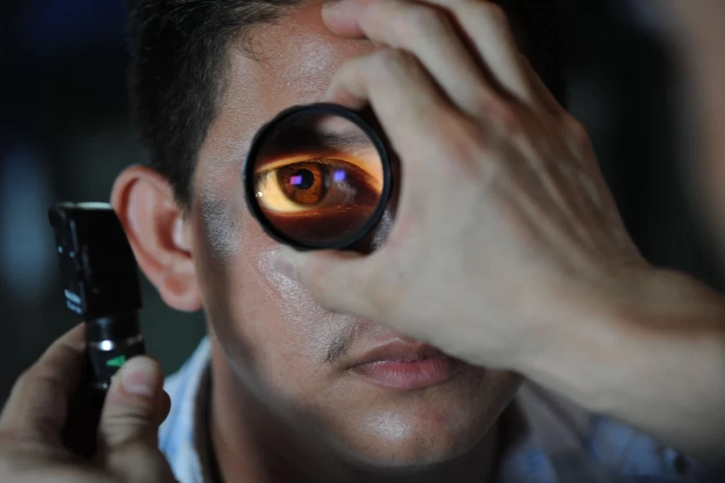 Optometrisa-Inflamación Ocular